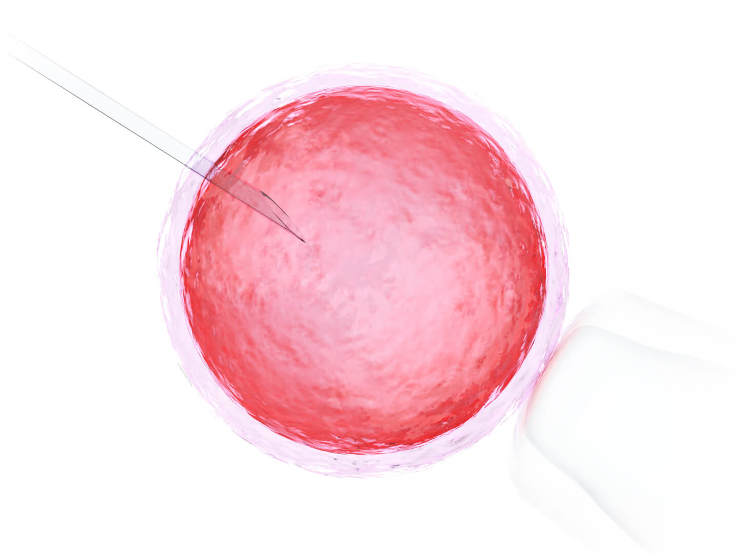 Fertilização in vitro