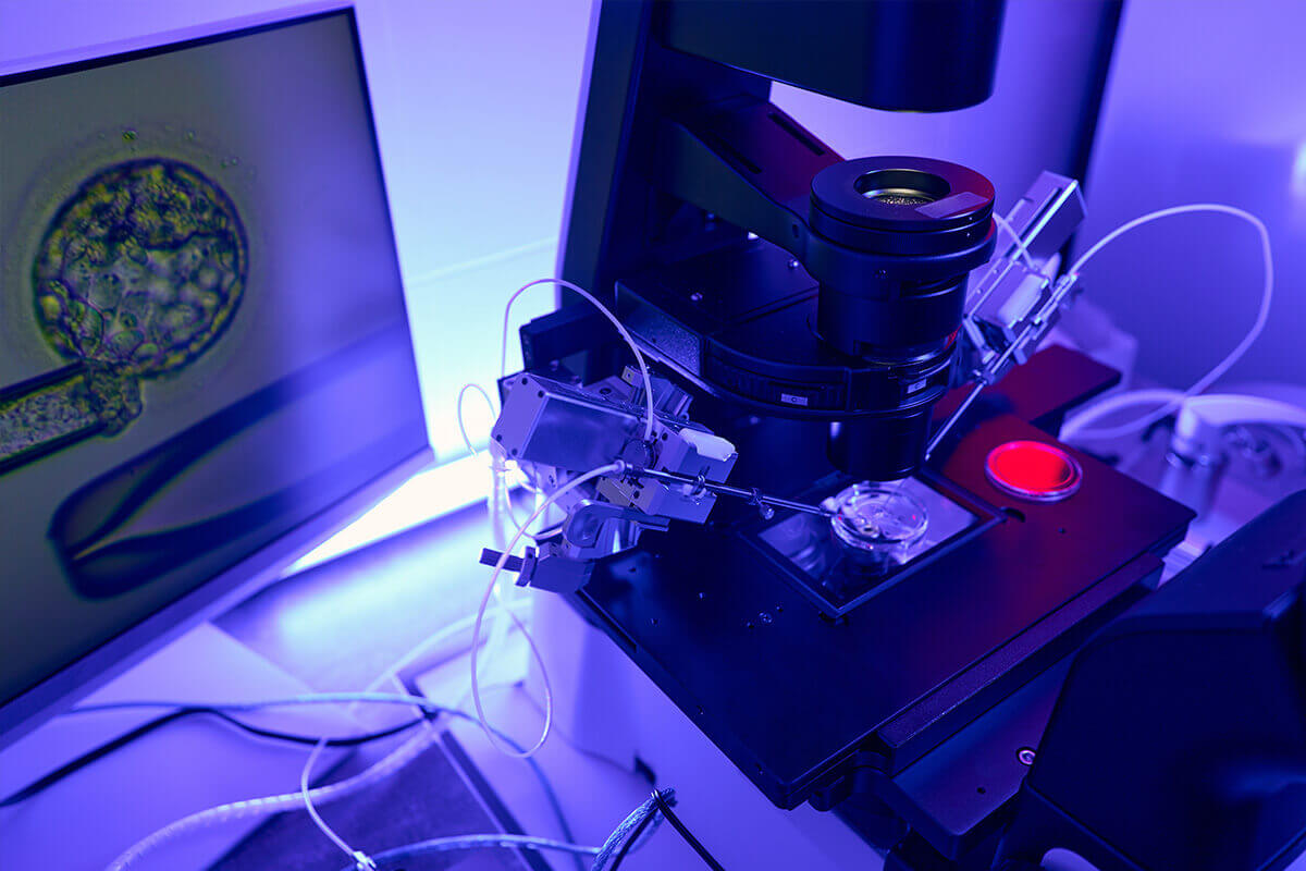 Fertilização in vitro SP