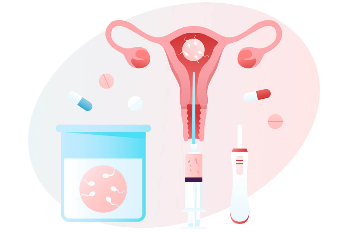 Inseminação Artificial