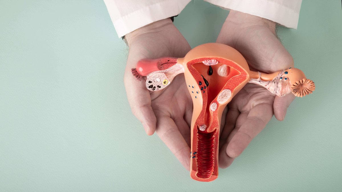 Endometriose e fiv: saiba como o procedimento lida com o diagnóstico