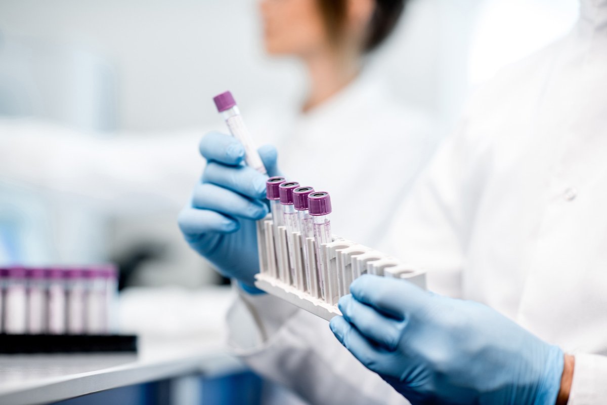 exames mais comuns para fazer a fertilização in vitro (FIV)