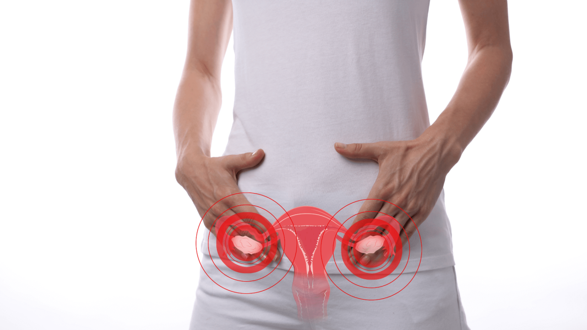 Falência ovariana: conheça o problema e quando investigá-lo