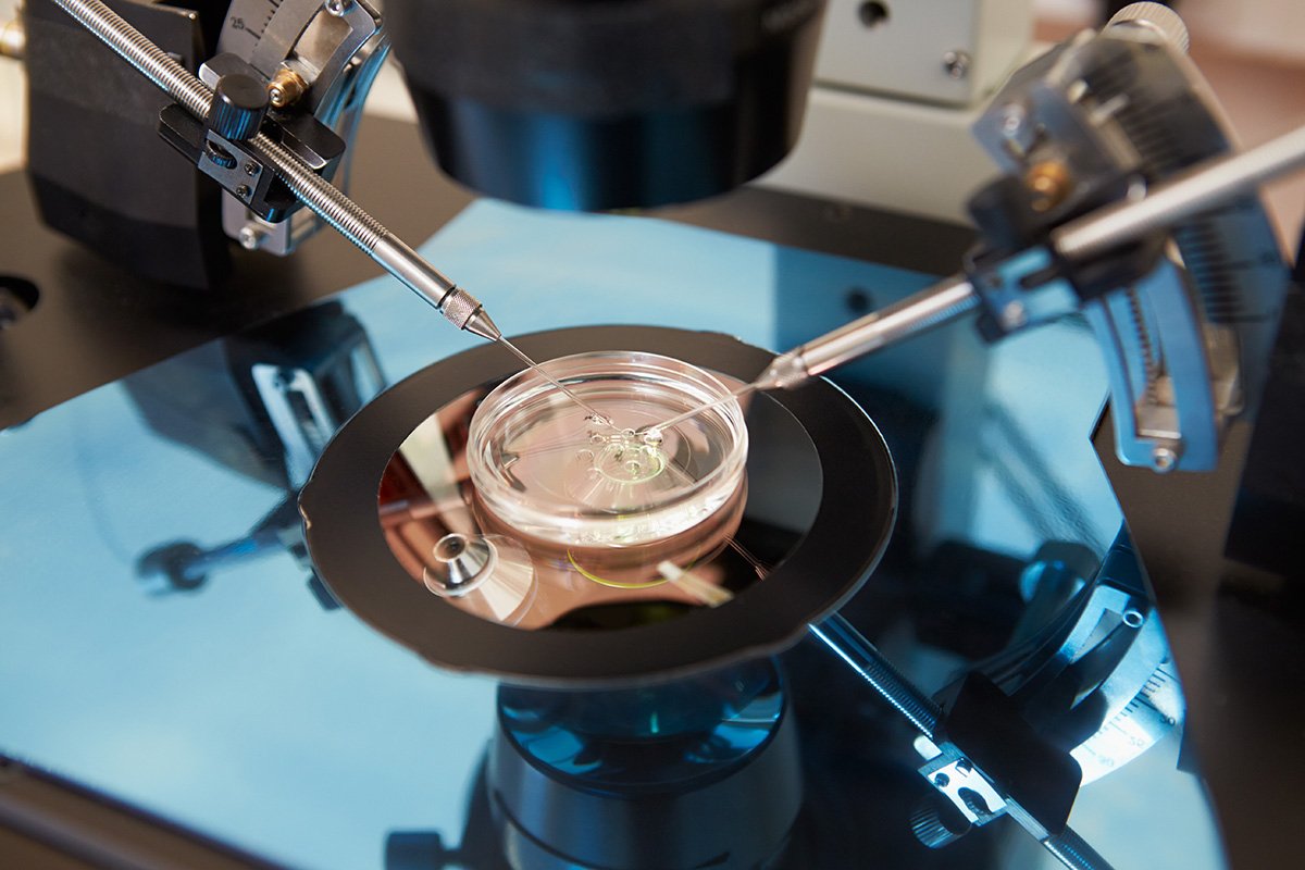 Consequências da fertilização in vitro e por que é um procedimento tão seguro?