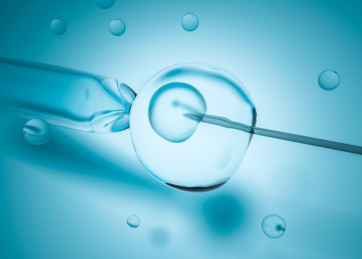 Icsi ? injeção intracitoplasmática de espermatozoide
