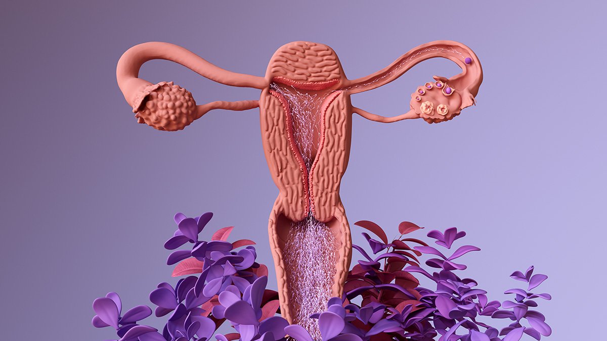 IIU - inseminação intrauterina